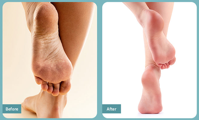 Nano Glass Foot File – Crystal Callus Remover for Heels & Feet