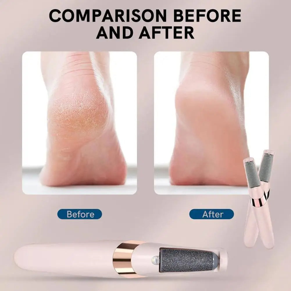 Rechargeable Electric Foot Grinder – Callus Remover & Dead Skin Scrubber for Heels & Feet