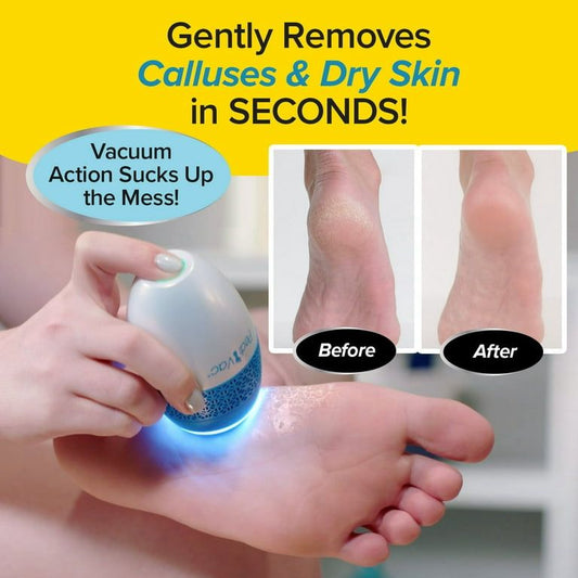 Pedi Vac Electric Foot Callus Remover with Vacuum